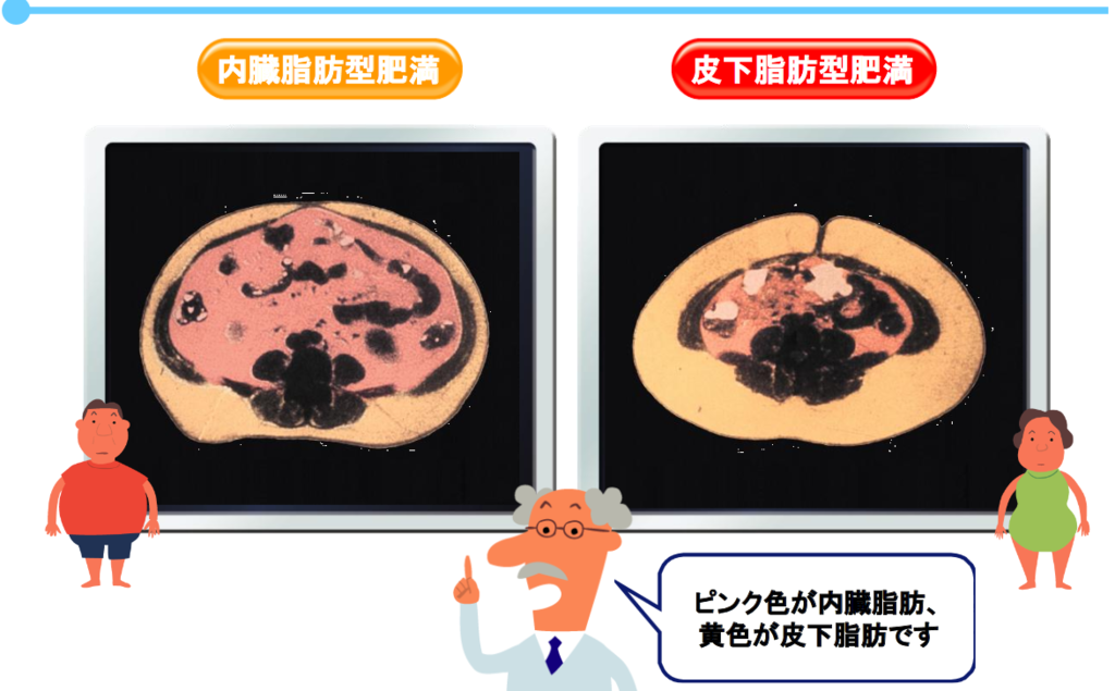 f:id:diet_ems:20160704202813p:plain f:id:diet_ems:20160704202813p:plain