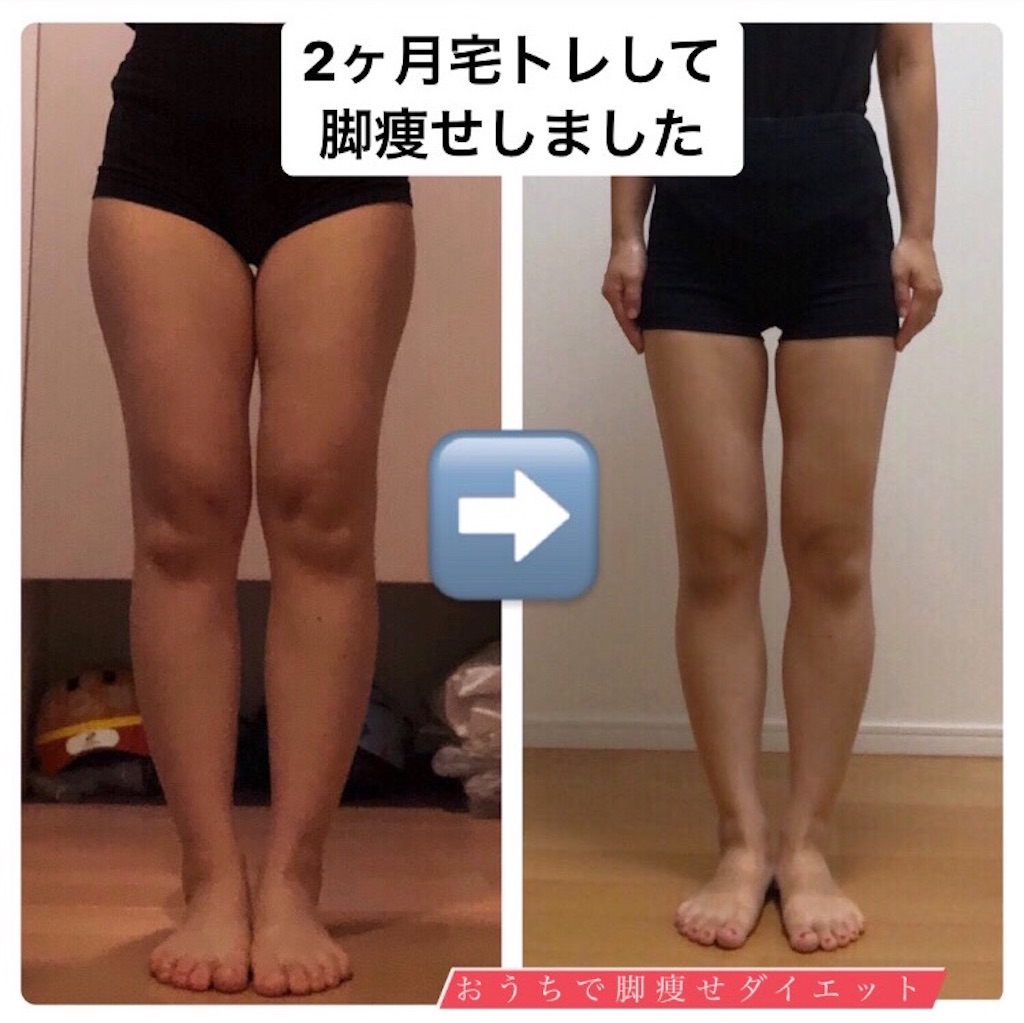 マジカルシェリーを買ってみました おうちで脚痩せダイエット