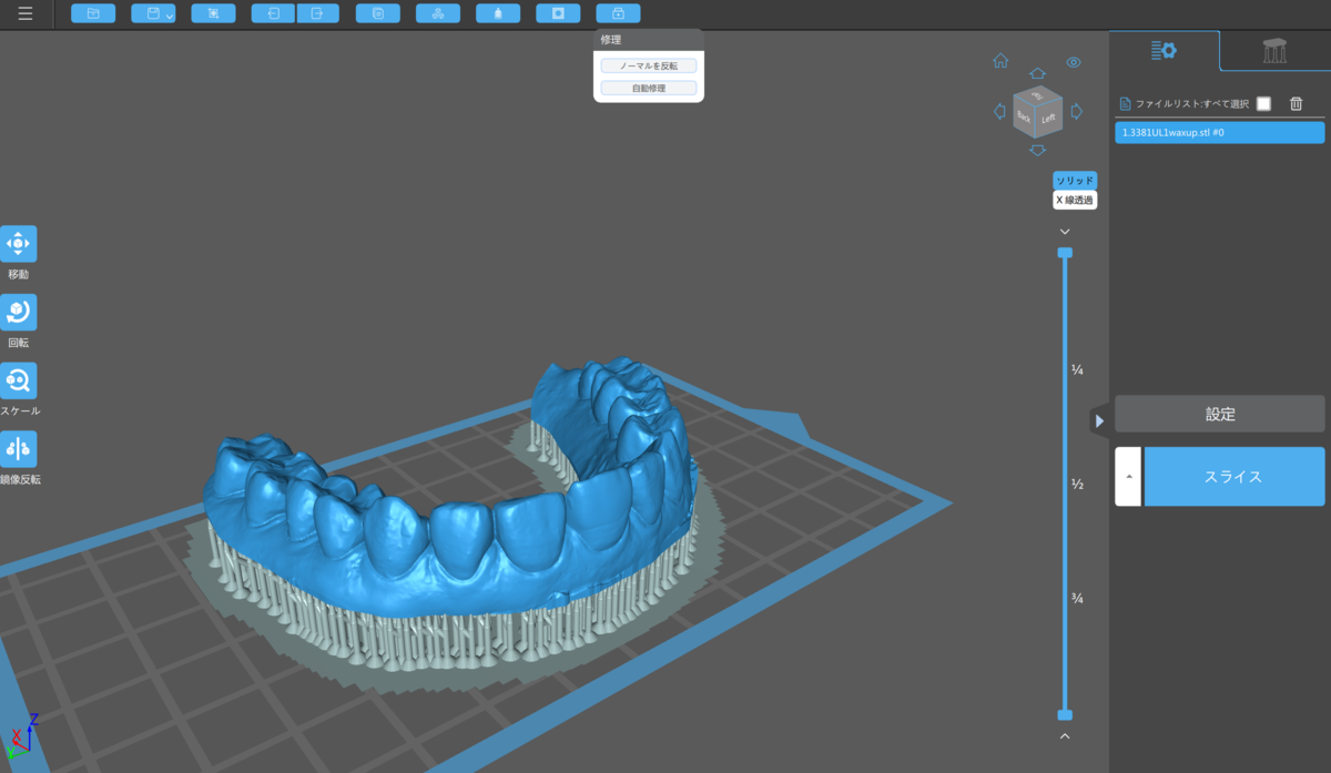 f:id:digitaldentistry:20211209183800p:plain