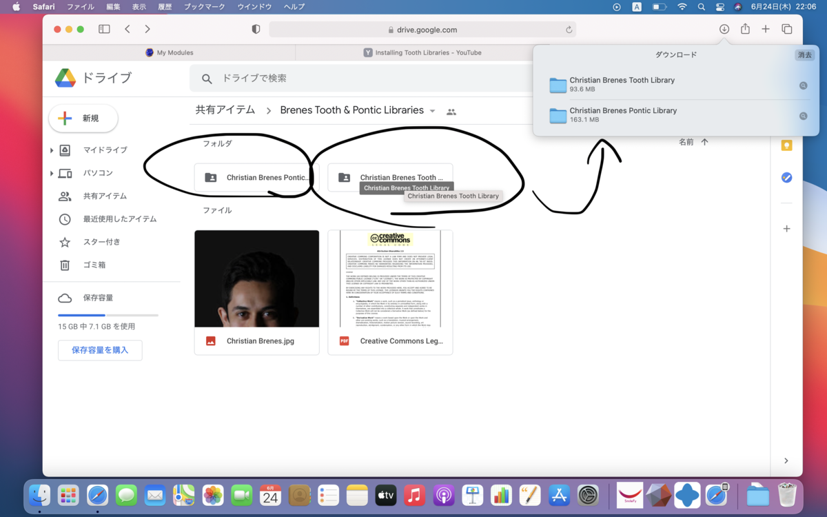 f:id:digitaldentistry:20220120150901p:plain