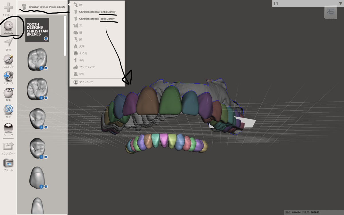 【裁断済】前歯部ダイレクトボンディング 3Dメソッド 上下巻セット 41Q-dY4AwVL.jpg_BO30,255,255,