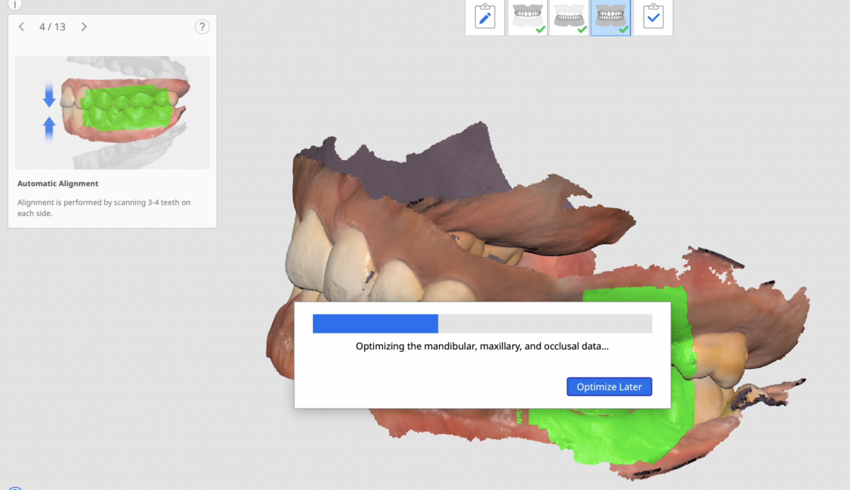 Medit i700をMacで使用する〜Macのスペックによるスキャン速度の比較（M1 MacBook Air VS M1 Pro