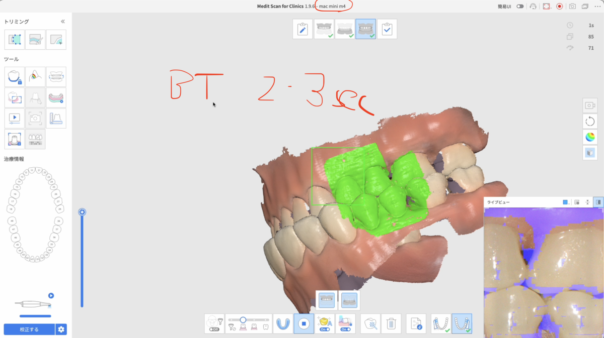 MacでMedit i700をもういちど詳しく調べてみる②Macのメモリ