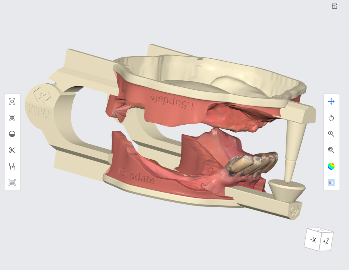 み~　すべておまとめ分 Medit Model Builder 1.5アップデート！強力なxSNAP付き - 3D歯科 の
