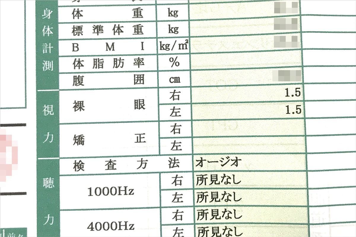 レーシック手術から10年経過 現在の視力や後遺症について Djモペのねこまんま