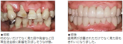 f:id:dkenty:20160206175540j:plain