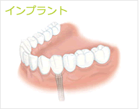 f:id:dkenty:20161227125532g:plain