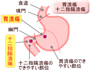 f:id:dmokuba:20180615144634g:plain
