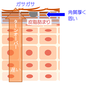 f:id:dobokutanuki:20180121103919p:plain