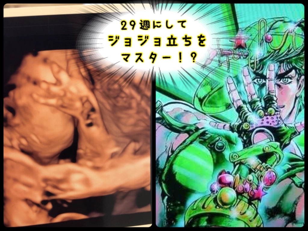 f:id:doctor29q:20180404200359j:plain