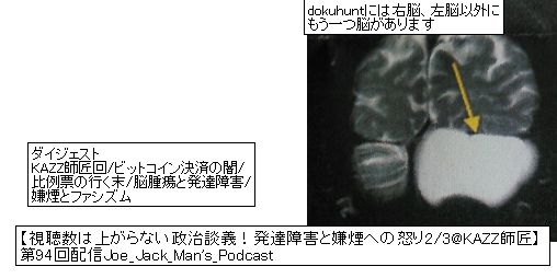 f:id:dokuhunt:20171023195718j:plain