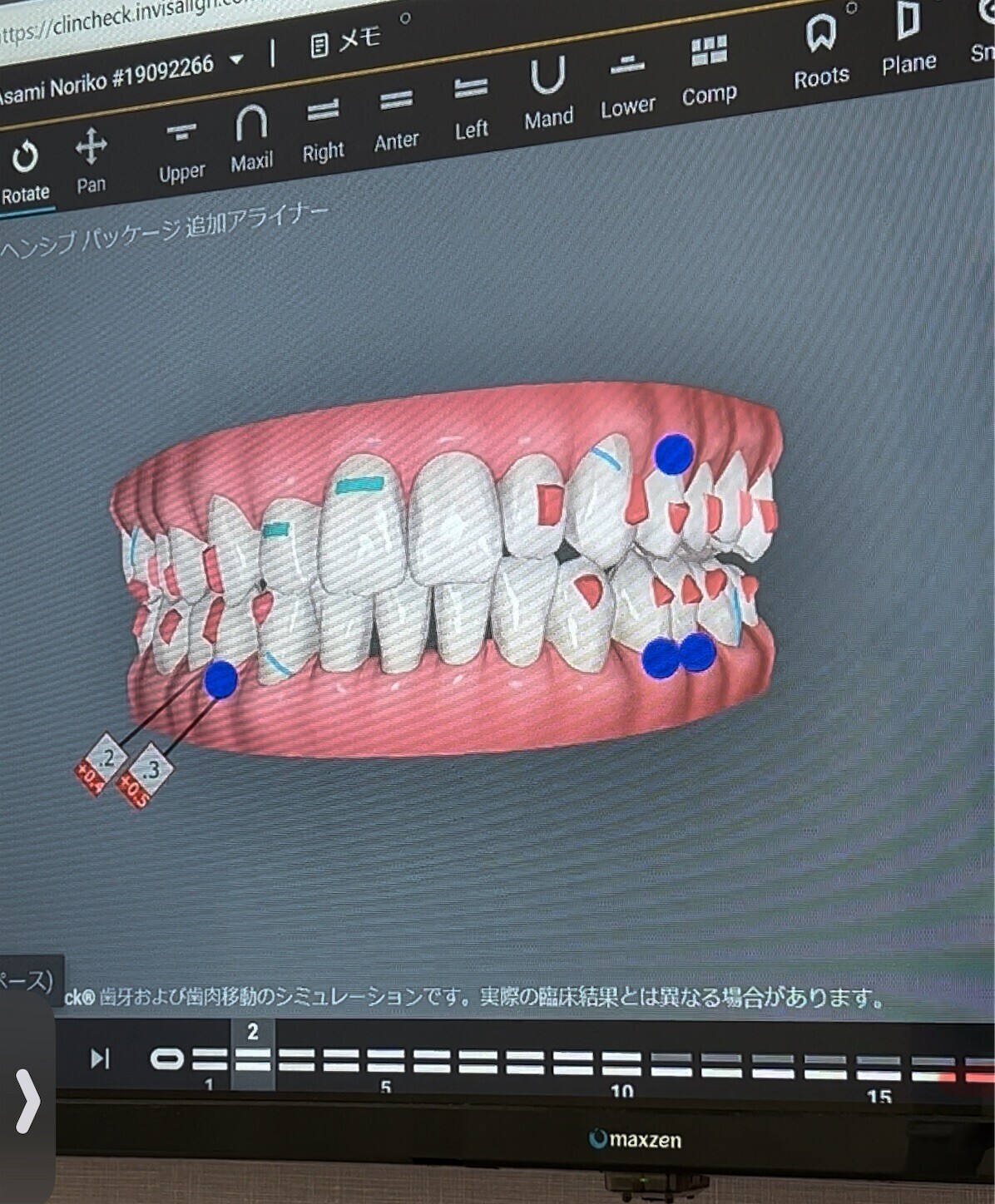 f:id:dollyosaka:20240521232002j:image