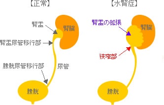 f:id:dontstopme:20210703181850j:plain