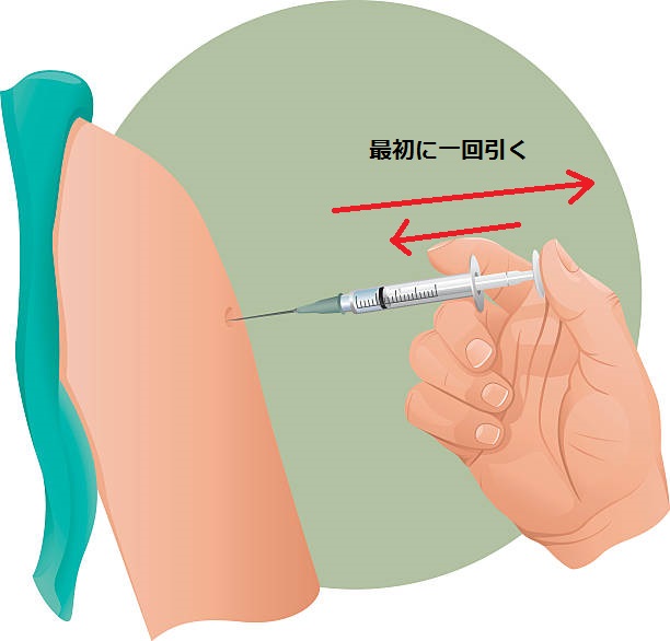 ワクチン接種時に注射器のピストンを一度引く理由 細かなことが気になる親父の備忘録