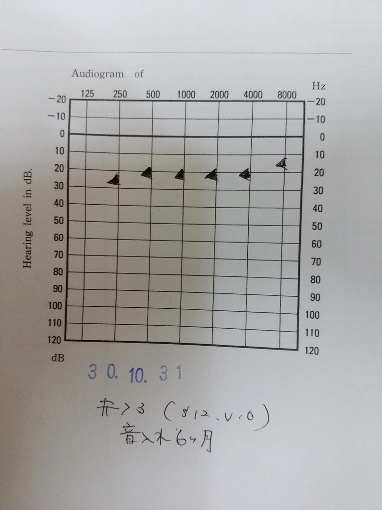 f:id:dorieru36:20181115165752j:plain f:id:dorieru36:20181115165752j:plain
