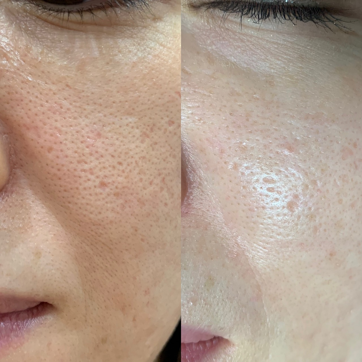 f:id:dr_tokyo_cosmetic_surgery:20220110125010p:plain