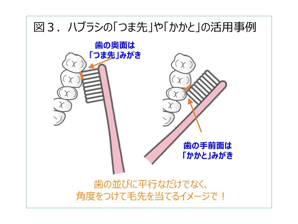 歯みがきの際の歯ブラシの当て方