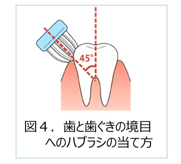 歯みがきの際の歯ブラシの当て方