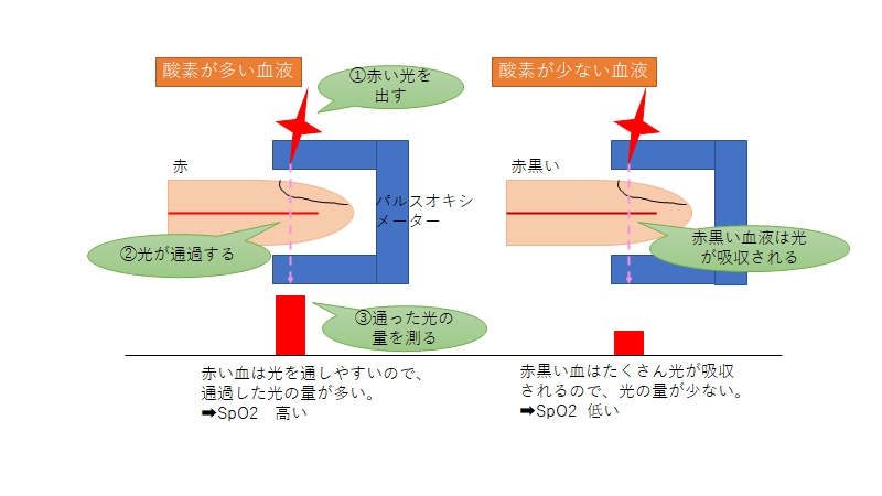 f:id:drtottoco:20210220102104p:plain