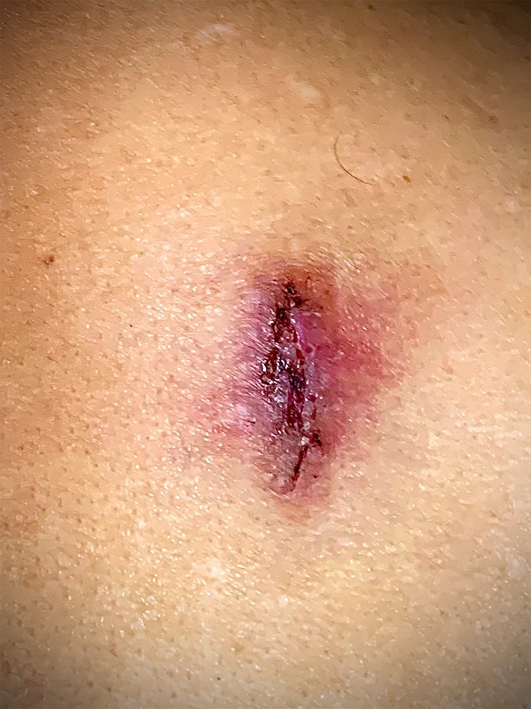 f:id:dv6:20200908075630j:image f:id:dv6:20200908075630j:image