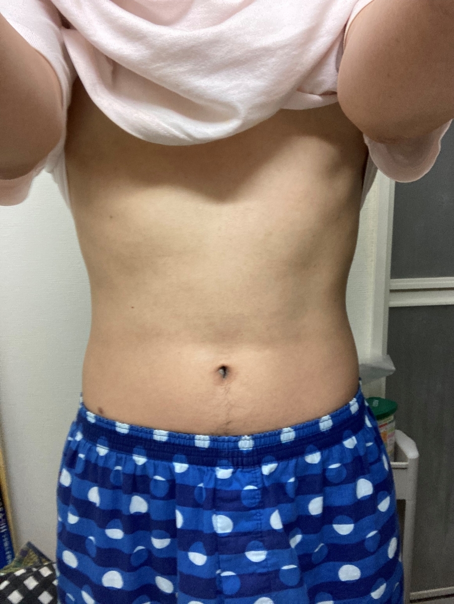 f:id:dyke_pulltop:20220114084712j:plain