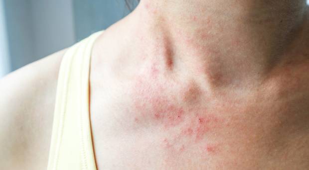f:id:dynamichomeopathy:20190510184957j:plain
