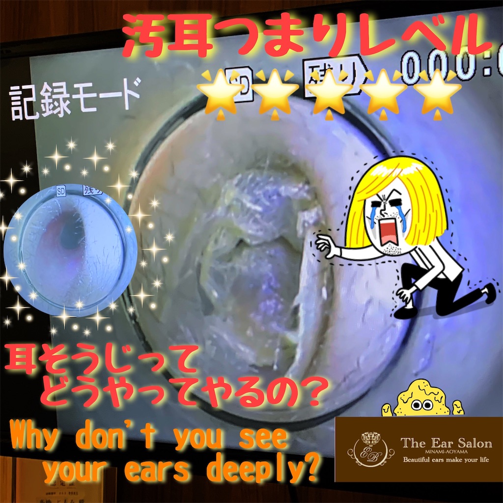 f:id:earwax-cleaning-mimisoji:20200307110820j:image f:id:earwax-cleaning-mimisoji:20200307110820j:image