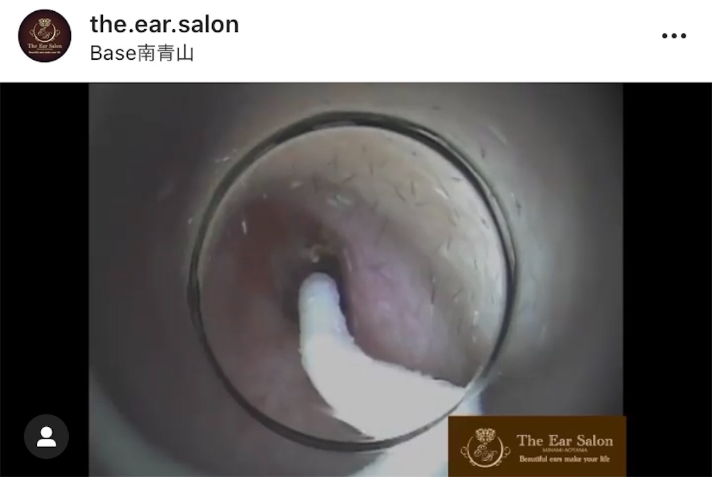 f:id:earwax-cleaning-mimisoji:20200908115248j:image f:id:earwax-cleaning-mimisoji:20200908115248j:image