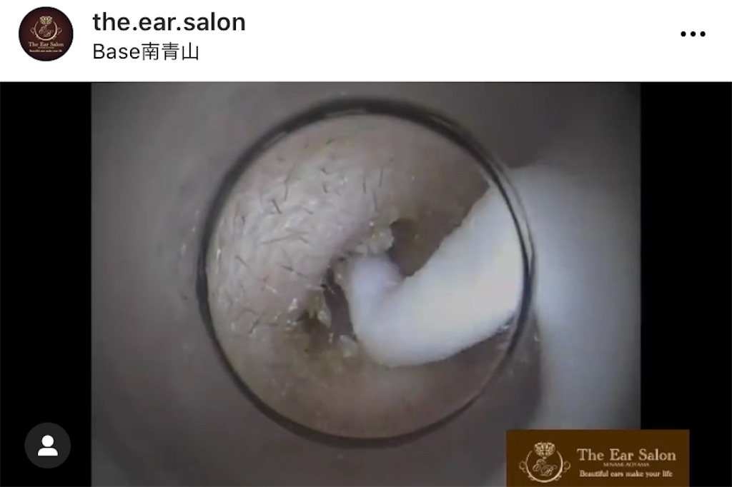 f:id:earwax-cleaning-mimisoji:20201121123313j:image f:id:earwax-cleaning-mimisoji:20201121123313j:image