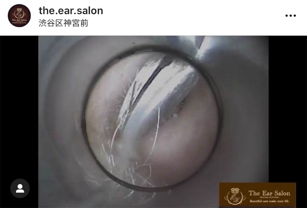 f:id:earwax-cleaning-mimisoji:20201207113236j:image f:id:earwax-cleaning-mimisoji:20201207113236j:image