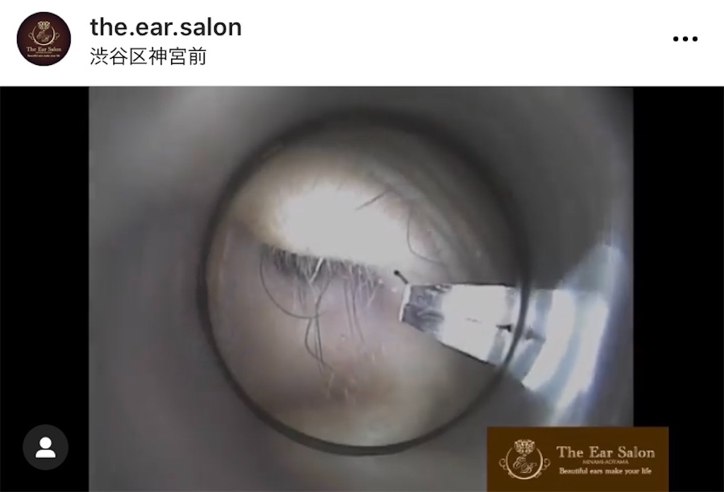 f:id:earwax-cleaning-mimisoji:20201211233225j:image f:id:earwax-cleaning-mimisoji:20201211233225j:image