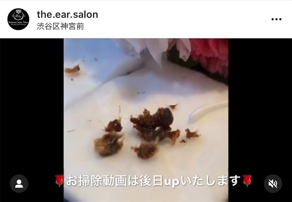 f:id:earwax-cleaning-mimisoji:20201219214324j:image f:id:earwax-cleaning-mimisoji:20201219214324j:image