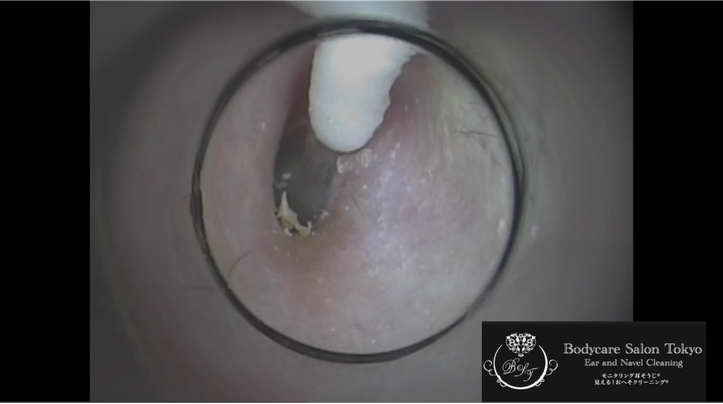 f:id:earwax-cleaning-mimisoji:20210514103643j:image
