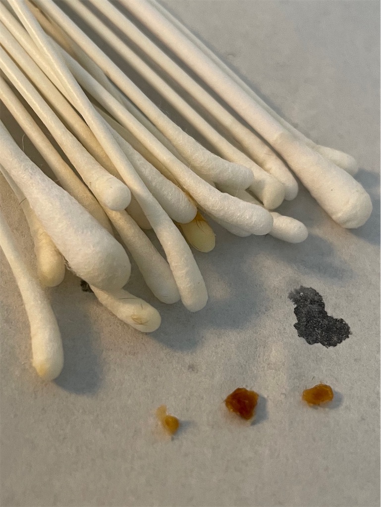 f:id:earwax-cleaning-mimisoji:20220922192542j:image f:id:earwax-cleaning-mimisoji:20220922192542j:image