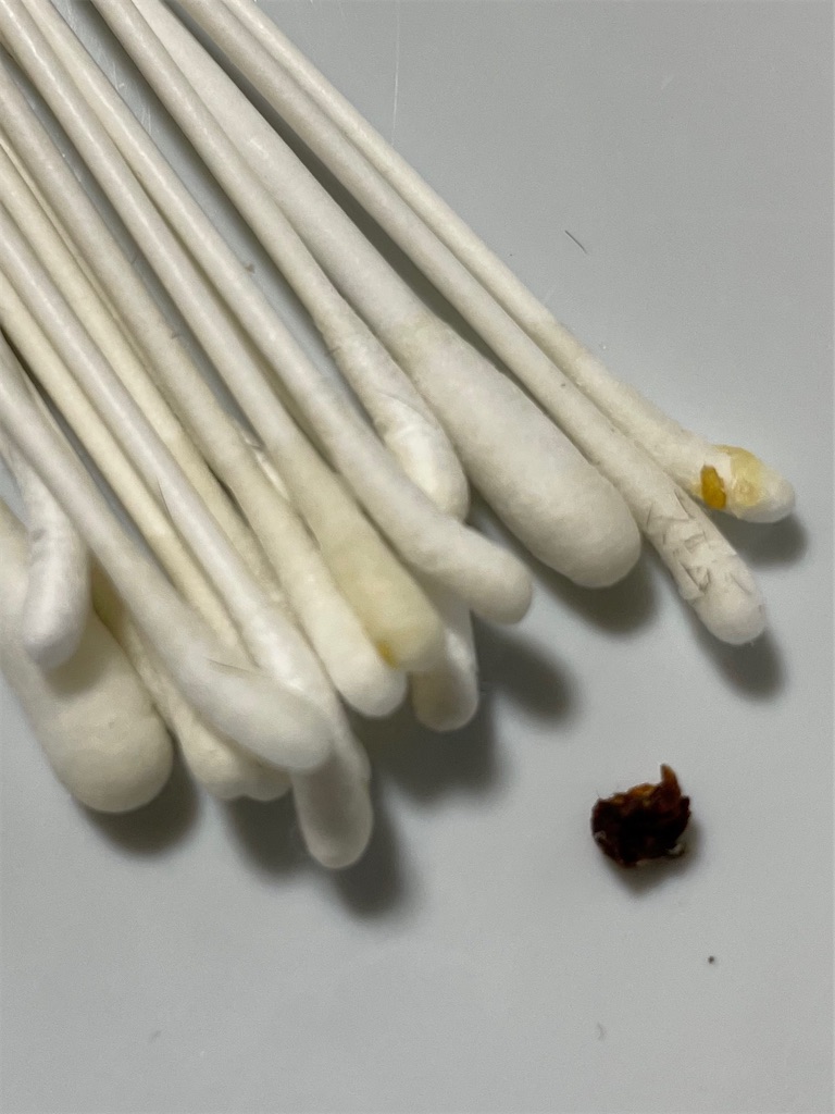 f:id:earwax-cleaning-mimisoji:20220922192558j:image f:id:earwax-cleaning-mimisoji:20220922192558j:image