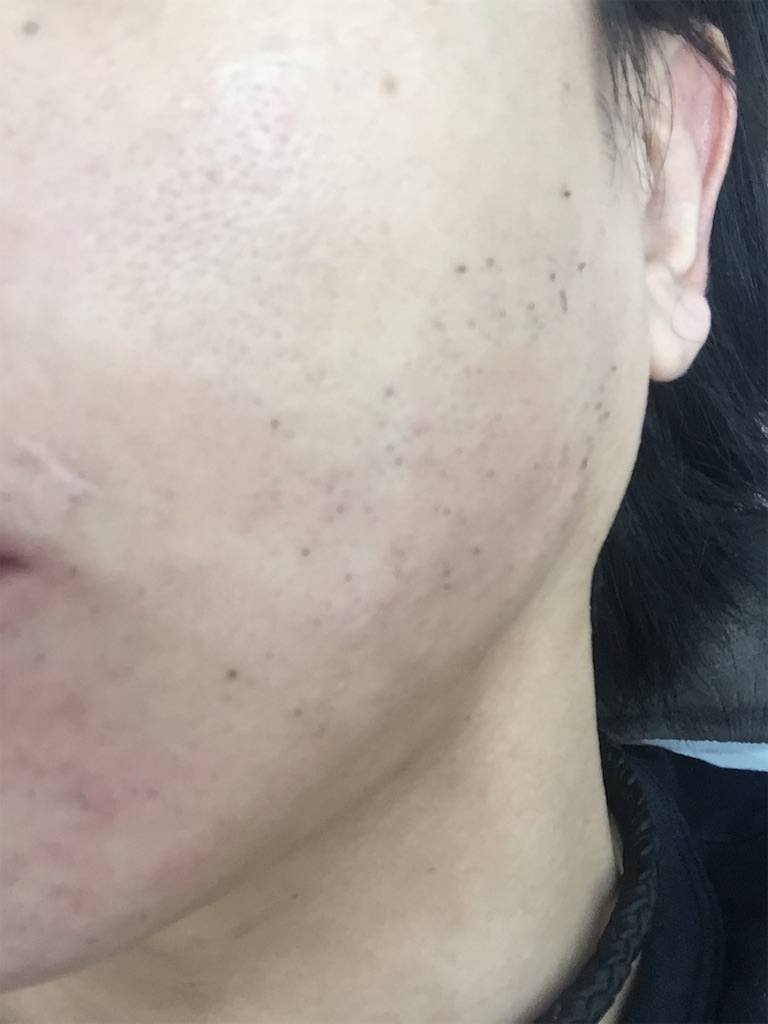 f:id:ebe0214:20190228055641j:image f:id:ebe0214:20190228055641j:image