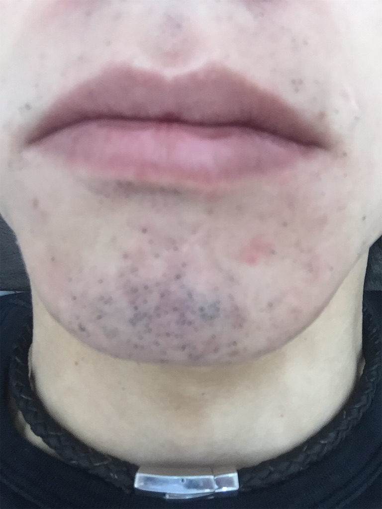 f:id:ebe0214:20190228055645j:image f:id:ebe0214:20190228055645j:image