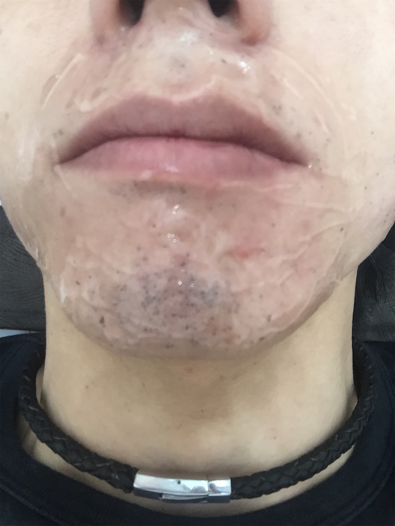 f:id:ebe0214:20190228055937j:image f:id:ebe0214:20190228055937j:image