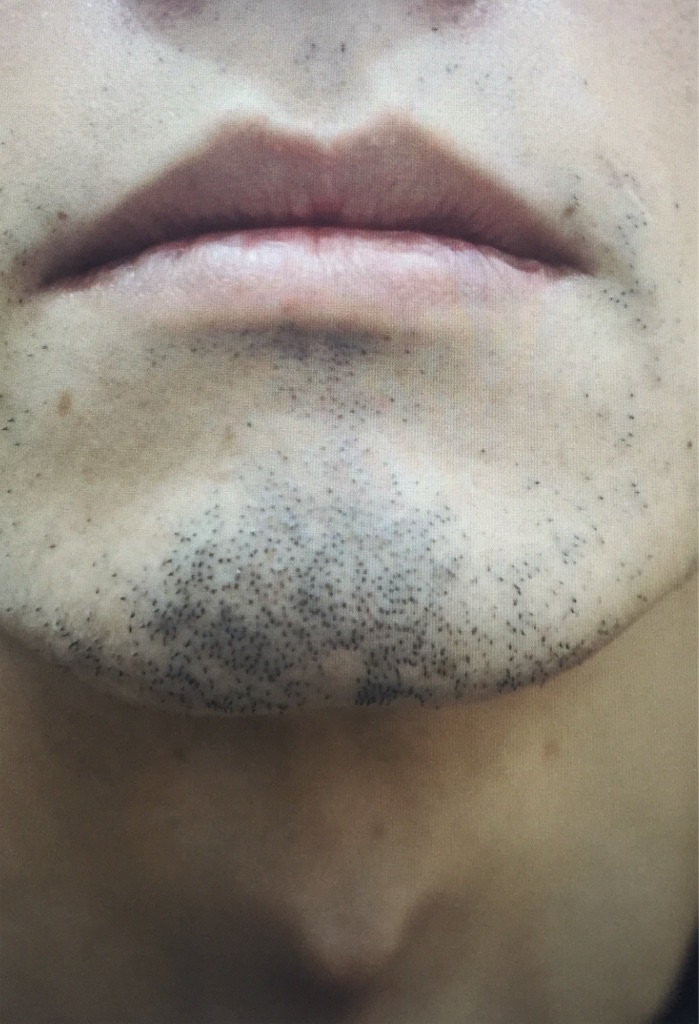 f:id:ebe0214:20190228062322j:image f:id:ebe0214:20190228062322j:image