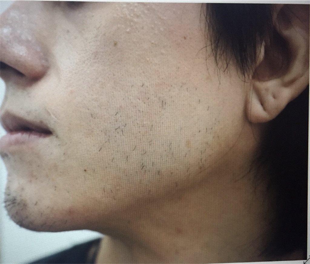 f:id:ebe0214:20190228062636j:image f:id:ebe0214:20190228062636j:image