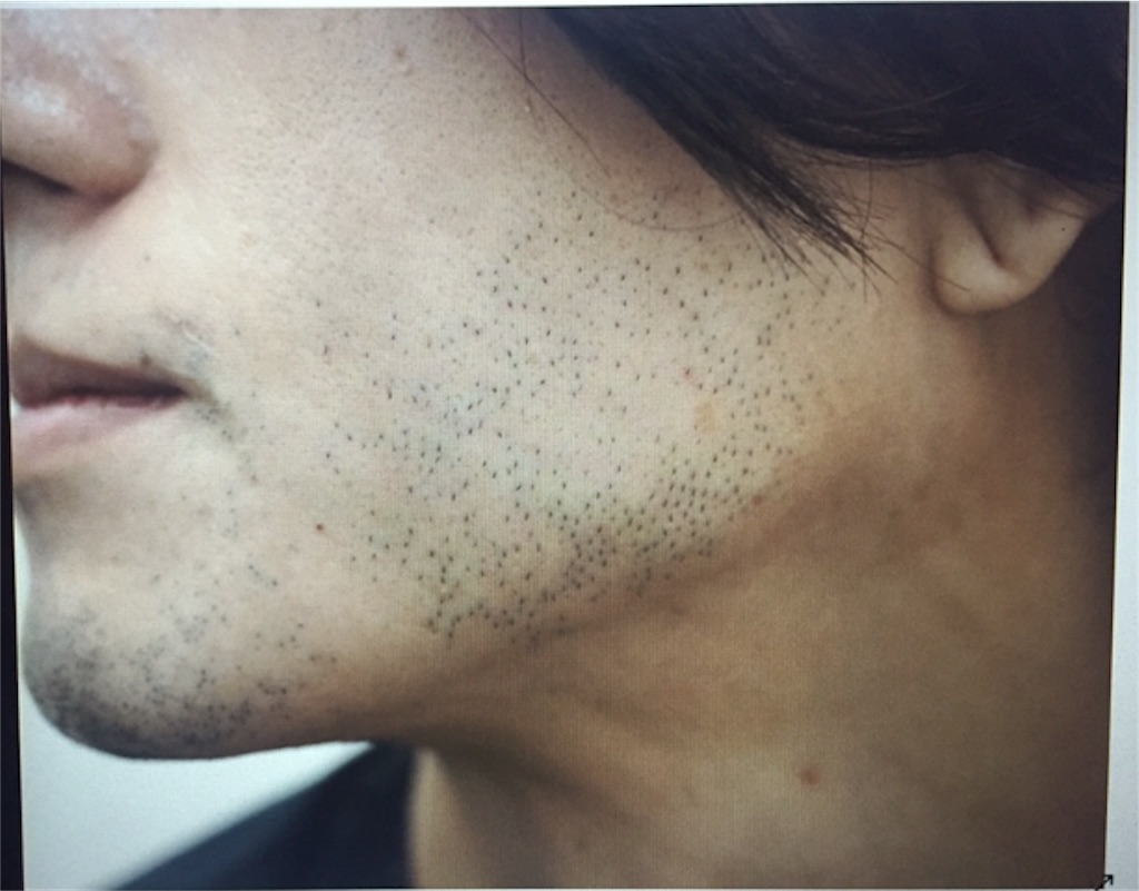 f:id:ebe0214:20190228062640j:image f:id:ebe0214:20190228062640j:image