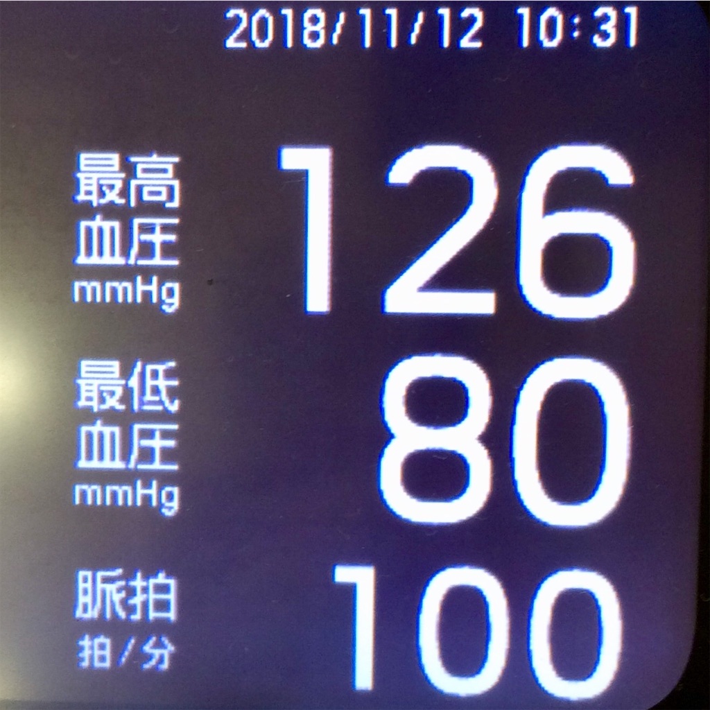 f:id:ebi2525104:20210530003656j:plain