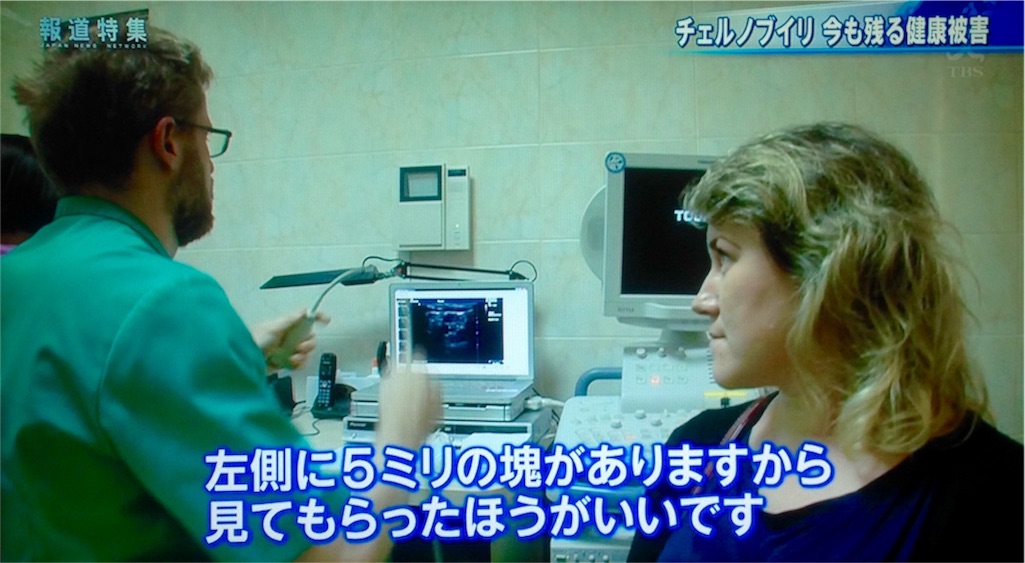 f:id:ebiharaism:20170729204047j:image f:id:ebiharaism:20170729204047j:image