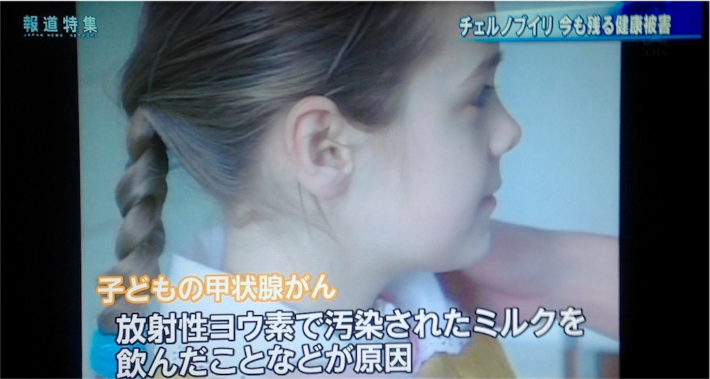 f:id:ebiharaism:20170729204554j:image f:id:ebiharaism:20170729204554j:image