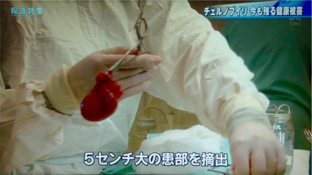 f:id:ebiharaism:20170729205332j:image f:id:ebiharaism:20170729205332j:image