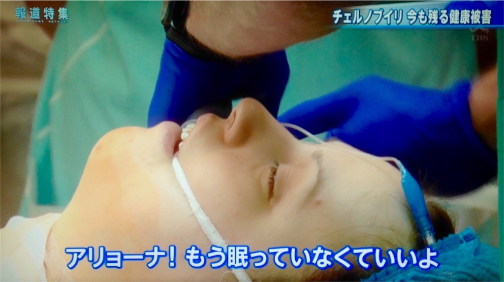 f:id:ebiharaism:20170729205517j:image f:id:ebiharaism:20170729205517j:image