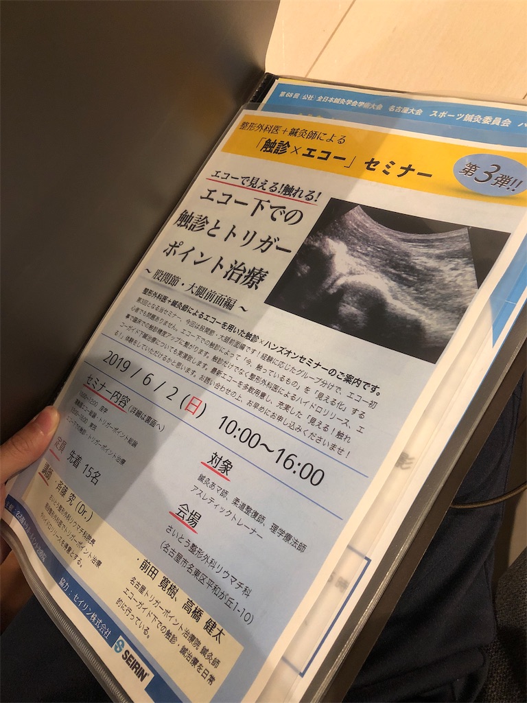 f:id:echo-acp:20190513000516j:image