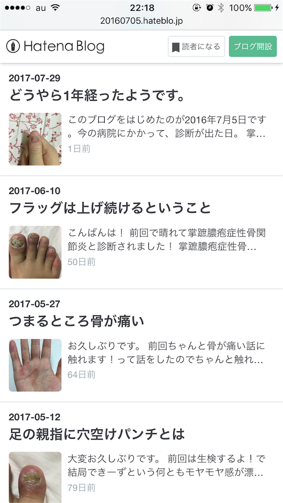 f:id:ecilaice:20170730221916p:image f:id:ecilaice:20170730221916p:image