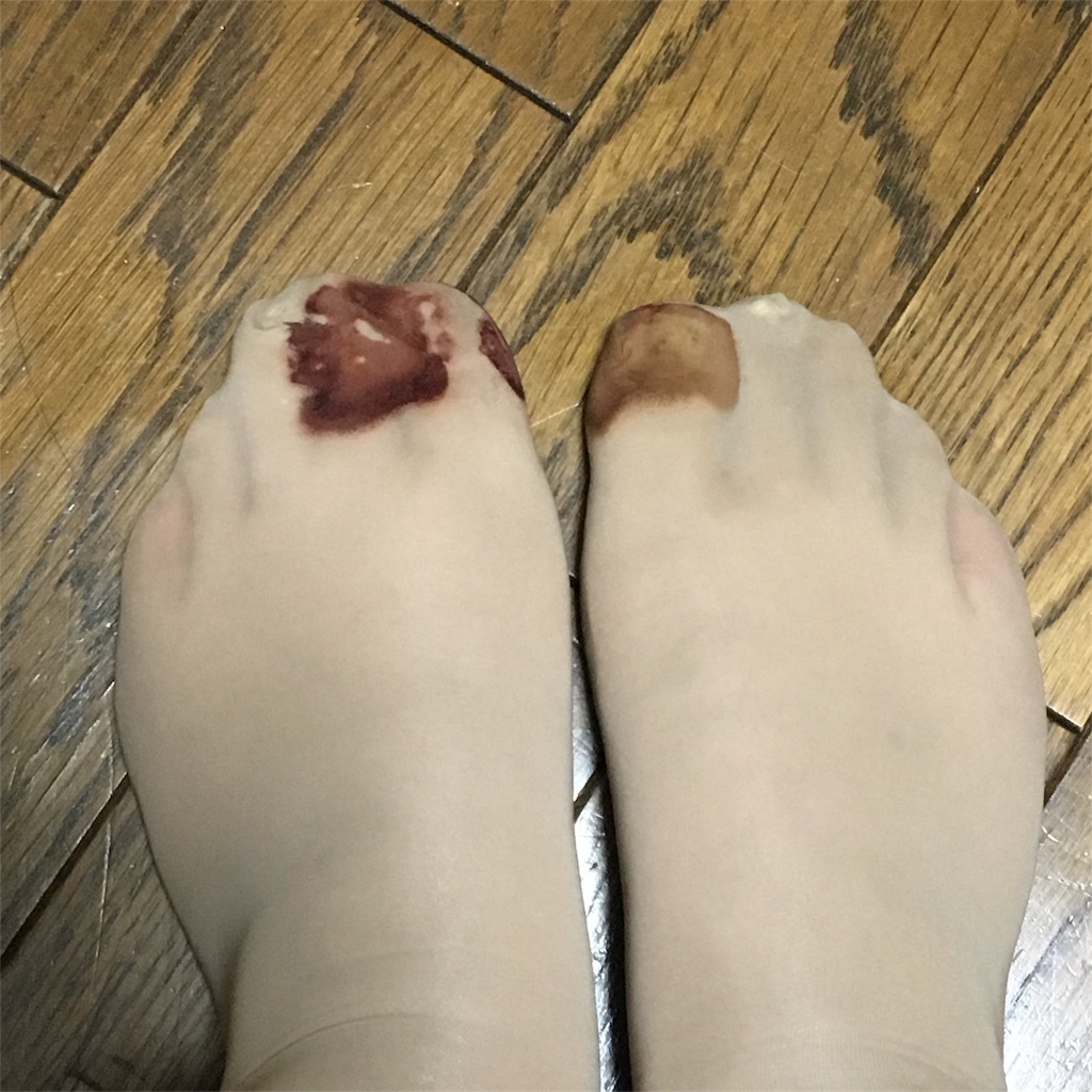 f:id:ecilaice:20171203230550j:image f:id:ecilaice:20171203230550j:image