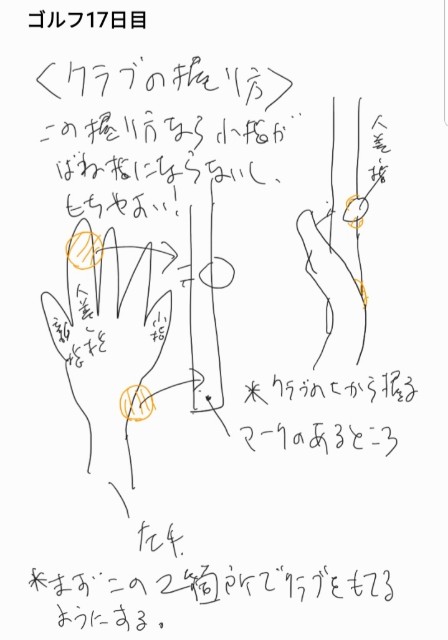 ゴルフ が原因で 小指が動きにくくなる ばね指 に その治療方法とは Ecobkk S Diary ゴルフ が原因で 小指が動きにくくなる ばね指 に その治療方法とは Ecobkk S Diary